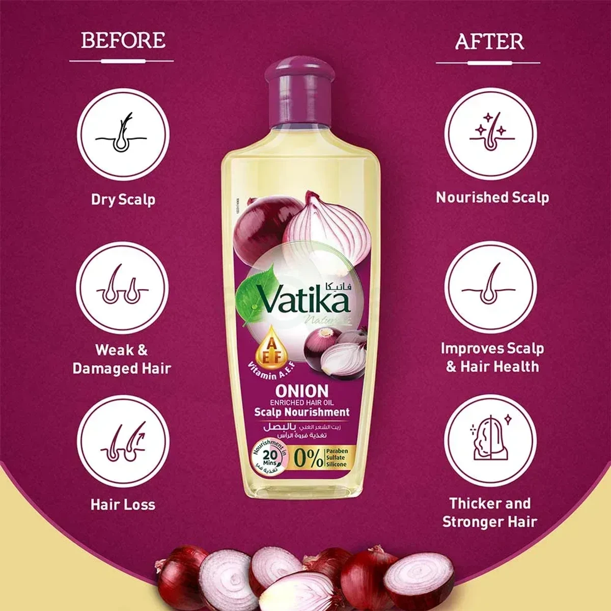 Vatika Naturals Onion Hair Oil 300ml - Image 3