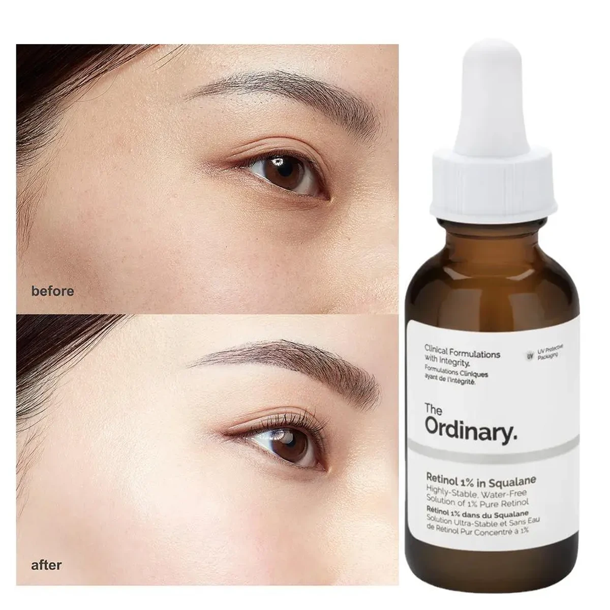 The Ordinary Retinol 1% In Squalano Serum (30ml) - Image 4