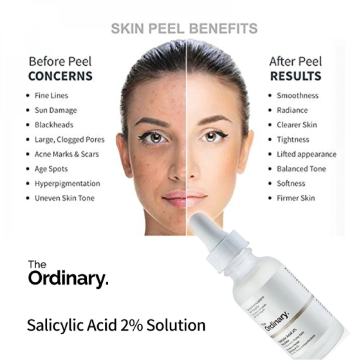 The Ordinary Niacinamide 10%+Zinc1% (30ml)